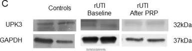 Anti-GAPDH antibody used in Western Blot (WB). GTX100118