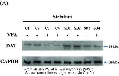 Anti-GAPDH antibody used in Western Blot (WB). GTX100118