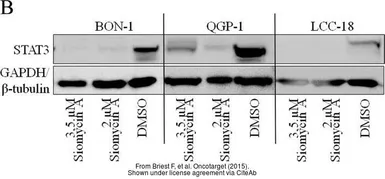 Anti-GAPDH antibody used in Western Blot (WB). GTX100118