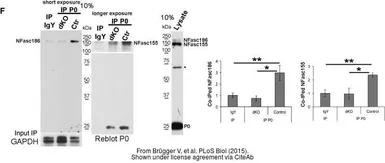 Anti-GAPDH antibody used in Western Blot (WB). GTX100118