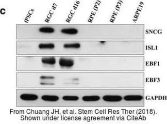 Anti-GAPDH antibody used in Western Blot (WB). GTX100118