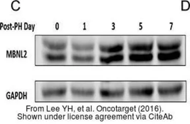 Anti-GAPDH antibody used in Western Blot (WB). GTX100118