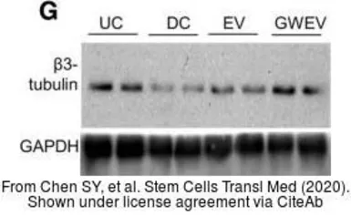Anti-GAPDH antibody used in Western Blot (WB). GTX100118