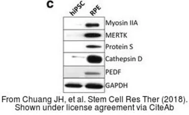 Anti-GAPDH antibody used in Western Blot (WB). GTX100118