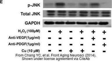 Anti-GAPDH antibody used in Western Blot (WB). GTX100118