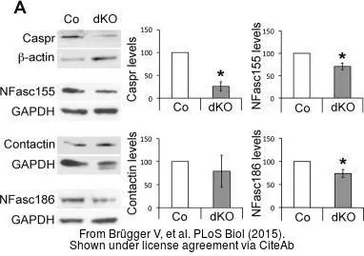 Anti-GAPDH antibody used in Western Blot (WB). GTX100118