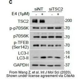 Anti-GAPDH antibody used in Western Blot (WB). GTX100118