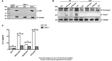 Anti-GAPDH antibody used in Western Blot (WB). GTX100118