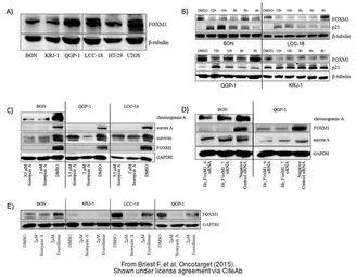 Anti-GAPDH antibody used in Western Blot (WB). GTX100118