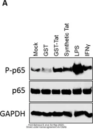 Anti-GAPDH antibody used in Western Blot (WB). GTX100118