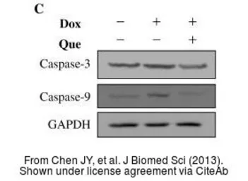 Anti-GAPDH antibody used in Western Blot (WB). GTX100118