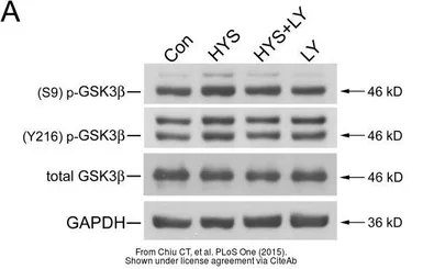Anti-GAPDH antibody used in Western Blot (WB). GTX100118