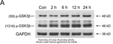Anti-GAPDH antibody used in Western Blot (WB). GTX100118