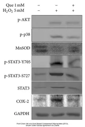 Anti-GAPDH antibody used in Western Blot (WB). GTX100118