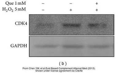 Anti-GAPDH antibody used in Western Blot (WB). GTX100118