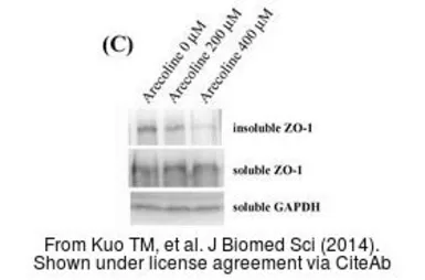 Anti-GAPDH antibody used in Western Blot (WB). GTX100118