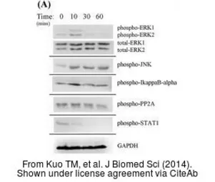 Anti-GAPDH antibody used in Western Blot (WB). GTX100118