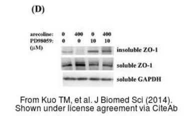 Anti-GAPDH antibody used in Western Blot (WB). GTX100118