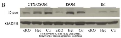 Anti-GAPDH antibody used in Western Blot (WB). GTX100118