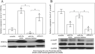 Anti-GAPDH antibody used in Western Blot (WB). GTX100118