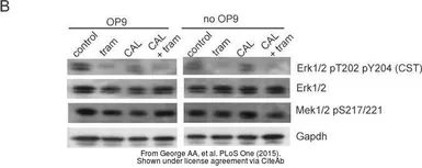 Anti-GAPDH antibody used in Western Blot (WB). GTX100118