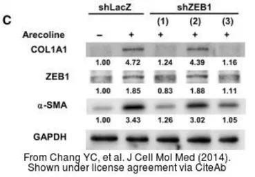 Anti-GAPDH antibody used in Western Blot (WB). GTX100118