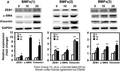Anti-GAPDH antibody used in Western Blot (WB). GTX100118