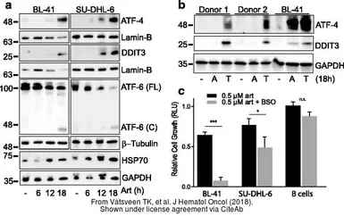 Anti-GAPDH antibody used in Western Blot (WB). GTX100118
