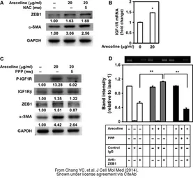 Anti-GAPDH antibody used in Western Blot (WB). GTX100118