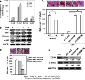 Anti-GAPDH antibody used in Western Blot (WB). GTX100118