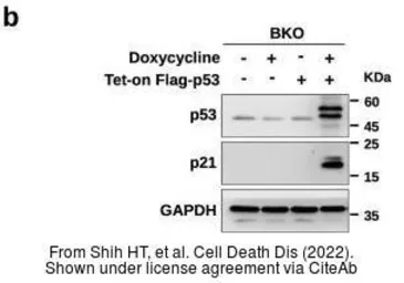 Anti-GAPDH antibody used in Western Blot (WB). GTX100118