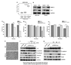 Anti-GAPDH antibody used in Western Blot (WB). GTX100118