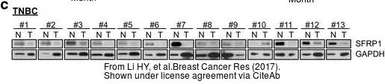 Anti-GAPDH antibody used in Western Blot (WB). GTX100118
