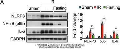 Anti-GAPDH antibody used in Western Blot (WB). GTX100118