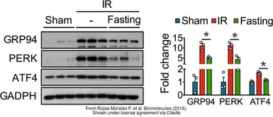 Anti-GAPDH antibody used in Western Blot (WB). GTX100118