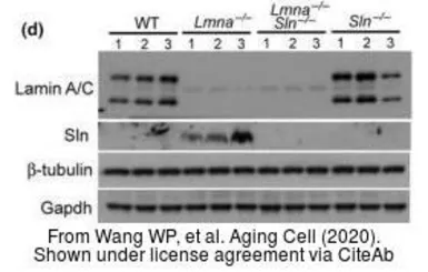 Anti-GAPDH antibody used in Western Blot (WB). GTX100118