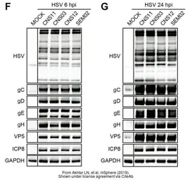 Anti-GAPDH antibody used in Western Blot (WB). GTX100118