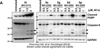 Anti-GAPDH antibody used in Western Blot (WB). GTX100118