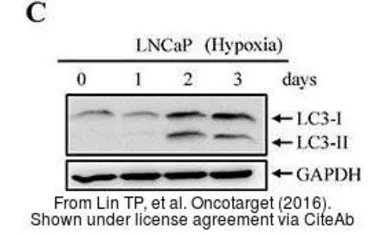 Anti-GAPDH antibody used in Western Blot (WB). GTX100118