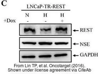 Anti-GAPDH antibody used in Western Blot (WB). GTX100118