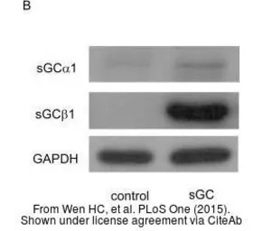 Anti-GAPDH antibody used in Western Blot (WB). GTX100118