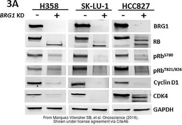 Anti-GAPDH antibody used in Western Blot (WB). GTX100118