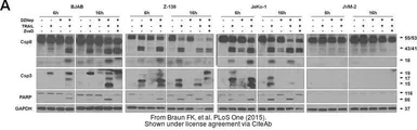 Anti-GAPDH antibody used in Western Blot (WB). GTX100118