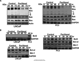 Anti-GAPDH antibody used in Western Blot (WB). GTX100118