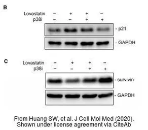 Anti-GAPDH antibody used in Western Blot (WB). GTX100118