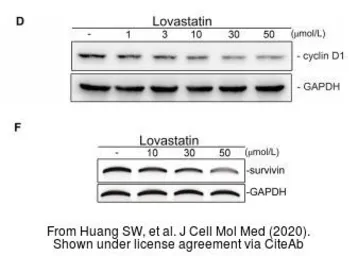 Anti-GAPDH antibody used in Western Blot (WB). GTX100118