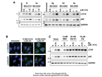 Anti-GAPDH antibody used in Western Blot (WB). GTX100118