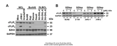 Anti-GAPDH antibody used in Western Blot (WB). GTX100118