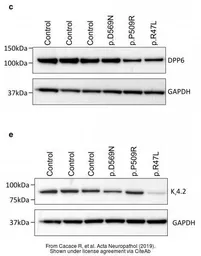Anti-GAPDH antibody used in Western Blot (WB). GTX100118