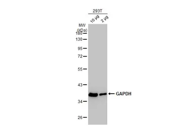 Anti-GAPDH antibody used in Western Blot (WB). GTX100118